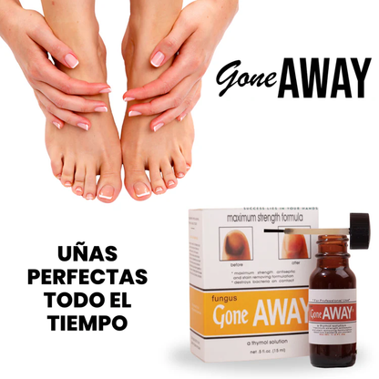 Fungus Gone Away | Uñas perfectas 15ML