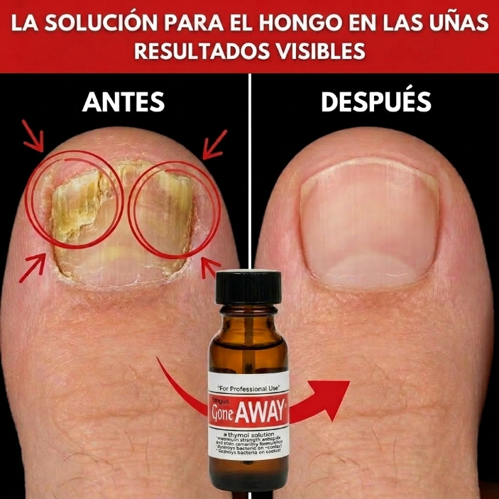 Fungus Gone Away | Uñas perfectas 15ML