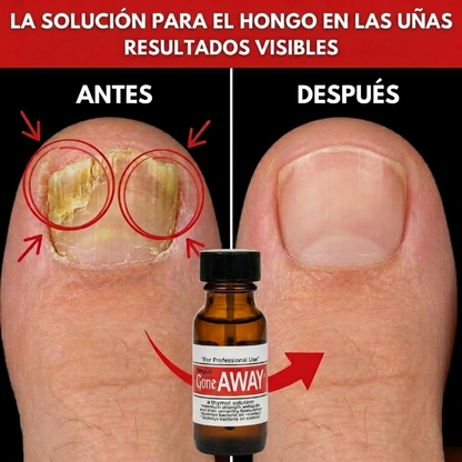 Fungus Gone Away | Uñas perfectas 15ML