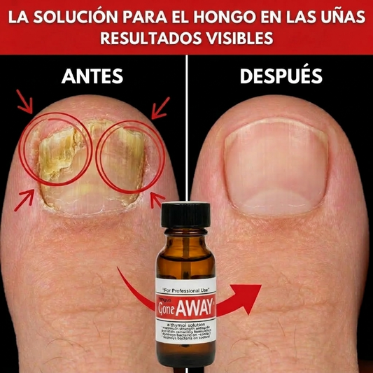 Fungus Gone Away | Uñas perfectas 15ML